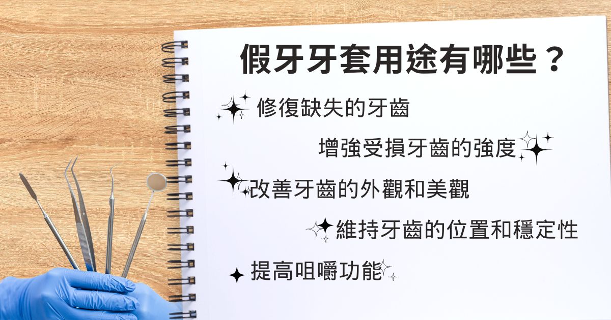 假牙牙套用圖有修補缺牙、增加受損牙強度、維持美觀等