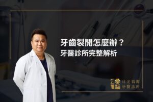 牙齒裂開怎麼辦？牙醫診所完整解析